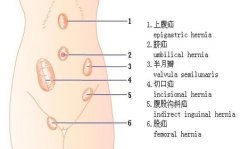 <b>女性小肠疝气会对以后生孩子有影响？</b>